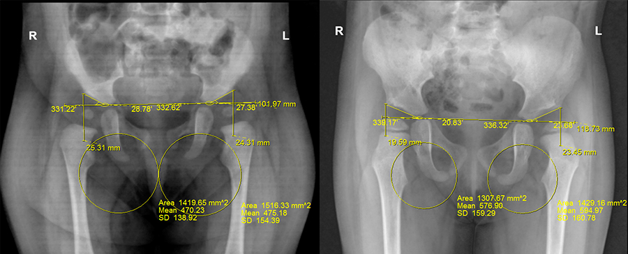 radiografia