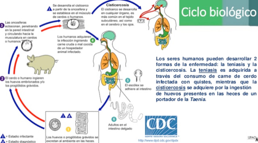 Neurocisticercosis 02