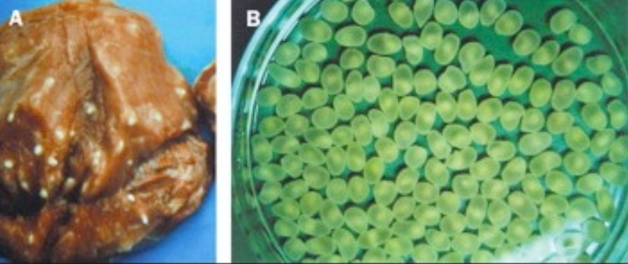 Neurocisticercosis 03